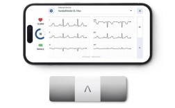 便携式心电监测仪品牌哪个好？