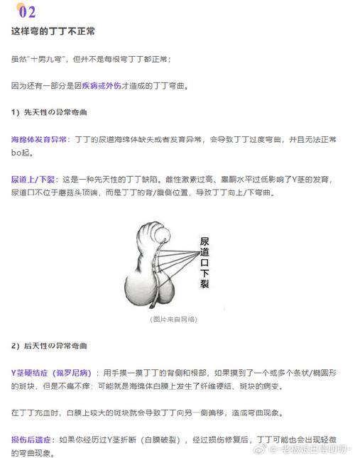 mentohust ddwrt教程-图3